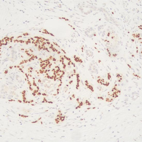 AM0166 Моноклональные мышиные антитела к Myogenin